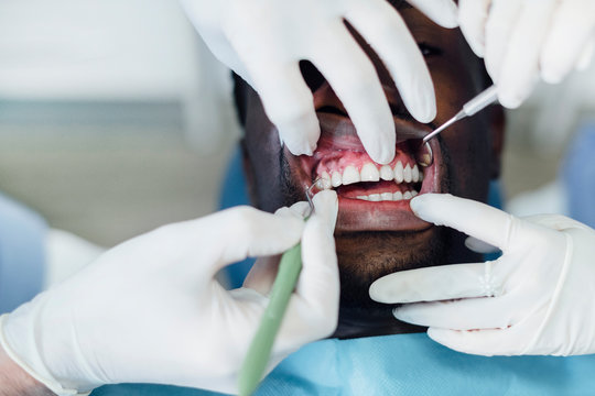 Close-up of patient getting dental treatment