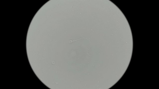 Human sperm under a microscope (spermatozoa), consists of sperm and seminal fluid, also contains various substances: antibodies, cholesterol, choline, citric acid, fructose and DNA ..., one