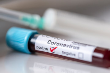 Blood sample for covid-19 testing