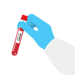 Hand holds a test tube containing a blood sample, test tube with blood for Covid-19