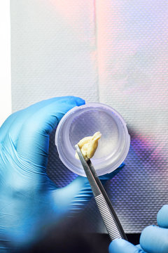 holding rat brain with forceps