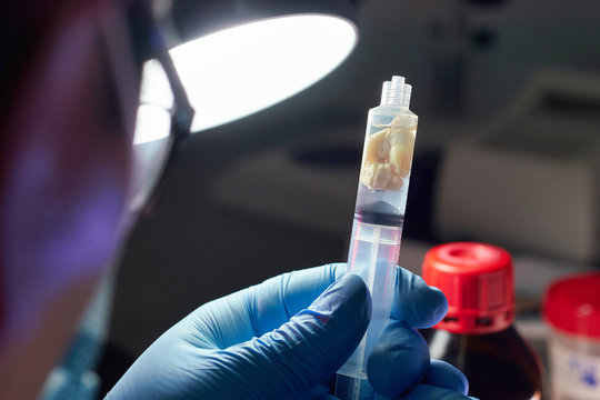 scientist examining rat brain