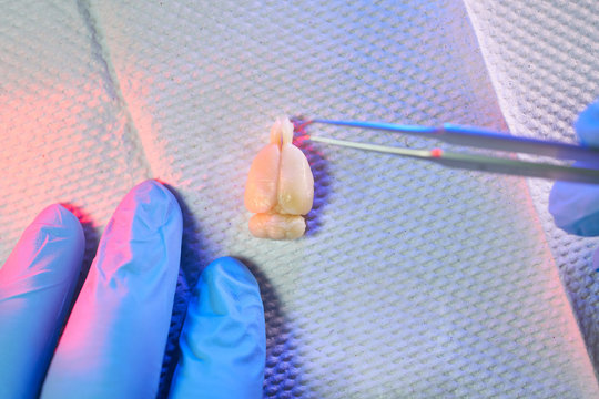 analyzing a rat brain