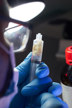 scientist holding a syringe with a rat brain