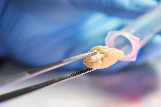 holding rat brain with forceps