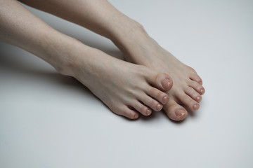close up of a woman's feet with one foot slightly crossed over the other, with broken toenail
