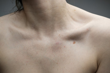 Woman with no face; stretching her neck and exposing her collar bones and décolletage; pale skin, freckles and moles