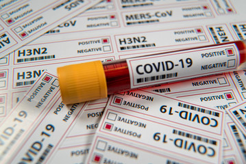 Covid-19 infectious disease, coronavirus a global threat
sars-cov 2 pasitive blood test