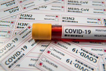Covid-19 infectious disease, coronavirus a global threat
sars-cov 2 pasitive blood test
