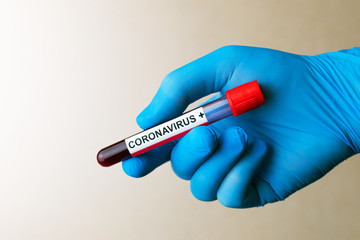 Hand in glove hold positive Coronavirus blood test result