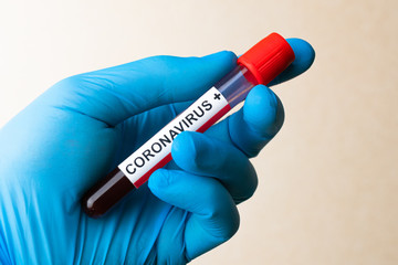 Naklejka premium Hand in glove hold positive Coronavirus blood test result