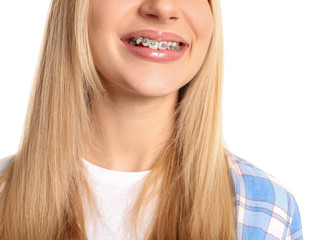 Young woman with dental braces on white background