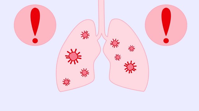 Animation of Covid-19 or the crown virus in the lungs and respiratory system of a person. The spread of the virus in human lungs. Alarm