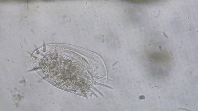 Euplotes in brackish water sample