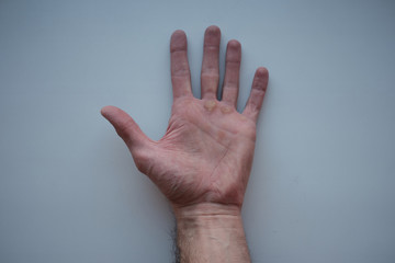 Male work palm with calluses.