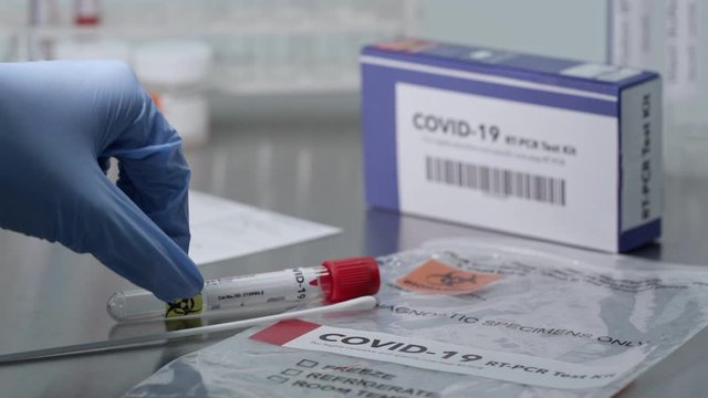Coronavirus covid-19 test kit on lab table as swab is set next to vile test tube.