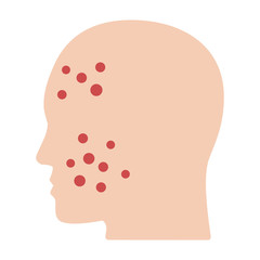 Acne or pimples on face flat vector color icon for medical apps and websites