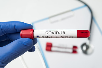 Naklejka premium Doctor with tube of biological sample contaminated by Coronavirus with label Covid-19.