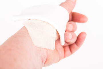 chemical burn on the wrist skin with hydroxide sodium acid. Household accident, because of gloves...