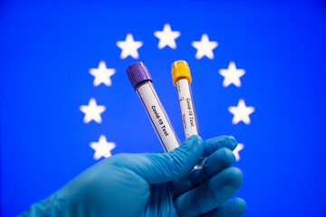 Corona virus or Covid-19 in European union, sample blood tube in hand with European union flag on background