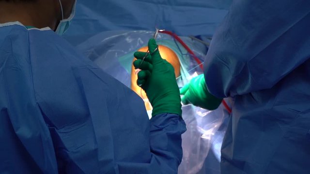 Doctor in surgery for ACL Reconstruction