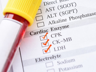 Blood sample tube for cardiac enzyme test, diagnosis for heart attack
