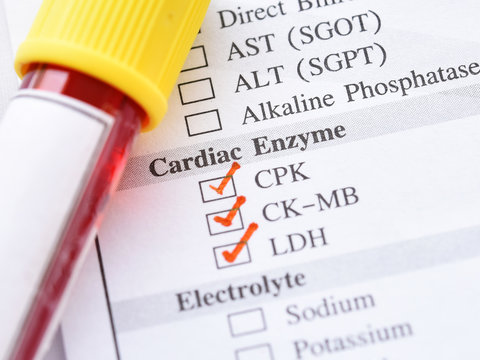 Blood sample tube for cardiac enzyme test, diagnosis for heart attack