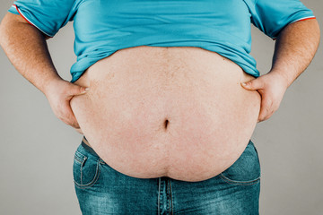 Overweight of a person's body with hands touching the abdomen. The concept of obesity