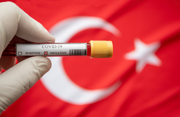 COVID-19 Pandemic Coronavirus concept ; Close-up of a Negative COVID-19 blood test sample tube with...