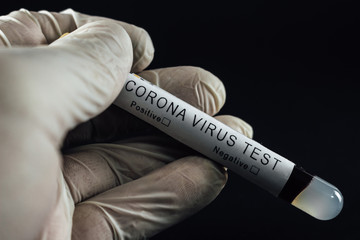 Obraz premium Close up of Corona virus lab test tube. Doctor wearing gloves holding a Covid-19 blood test sample. Pandemia prevention, medical healthcare and treatment concept, black background.