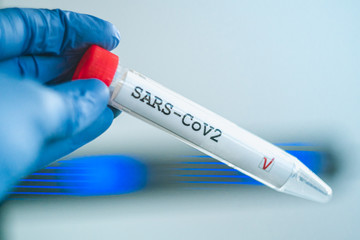 Obraz premium Coronavirus test. Hand in gloves holds a test tube on blurred laboratory background. COVID-19 or SARS-CoV-2 test concept