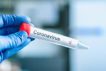 Obraz premium Coronavirus test. Hand in gloves holds a test tube on blurred laboratory in the background. COVID-19 or SARS-CoV-2 test.