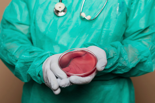 Doctor showing a blood agar plate