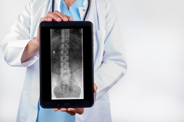 Orthopäde mit einer Röntgenaufnahme einer Wirbelsäule