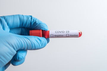 Fototapeta premium Blood sample tube positive with COVID-19 virus or novel coronavirus 2019 found in Wuhan, China