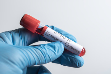 Fototapeta premium Blood sample tube positive with COVID-19 virus or novel coronavirus 2019 found in Wuhan, China