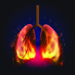 Burning lungs from a virus COVID-19 coronavirus, burns lungs, tuberculosis, pneumonia - 336631057