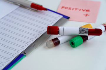tested positive for the coronavirus. medical flask with a blood test for the virus COVID-19. analysis with the bar code
