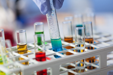 Examination of samples in the laboratory. Close up of test tubes with test material.