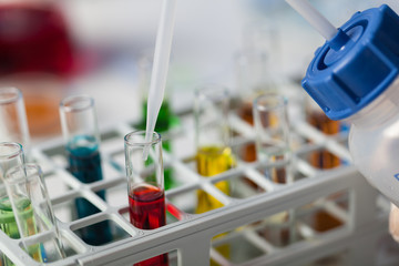 Examination of samples in the laboratory. Close up of test tubes with test material.