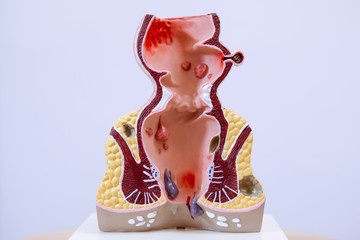 Medical dummy of internal organs.