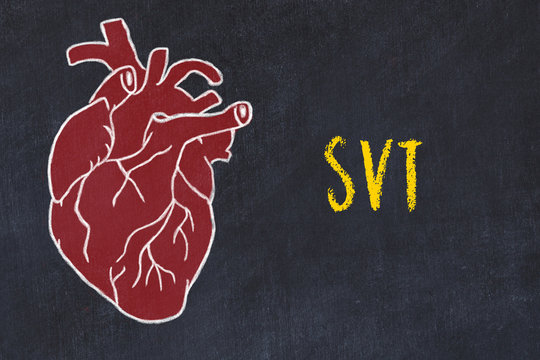 587 Best Svt Images Stock Photos Vectors Adobe Stock