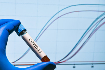 Real-time PCR testing on COVID-19.