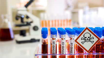 A hazard sign on the test tubes of Covid-19 or coronavirus