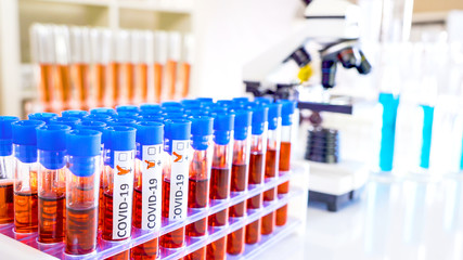 The equipments inside the laboratory with the coronavirus test samples