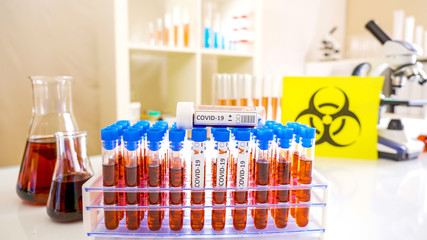 The blood samples with the covid-19 positive on the rack for coronavirus