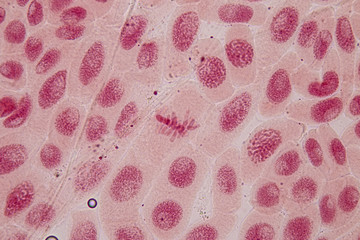 Root tip of Onion and Mitosis cell in the Root tip of Onion under a microscope.
