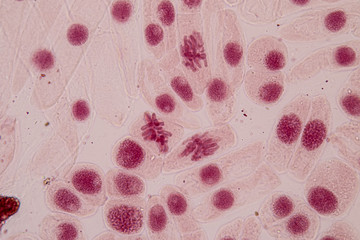 Root tip of Onion and Mitosis cell in the Root tip of Onion under a microscope.
