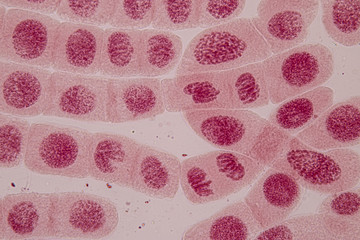 Root tip of Onion and Mitosis cell in the Root tip of Onion under a microscope.
