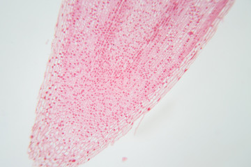 Root tip of Onion and Mitosis cell in the Root tip of Onion under a microscope.
